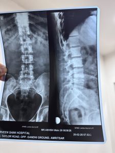 교통사고 허리디스크 합의금, 합의 전 꼭 확인해야 할 것들